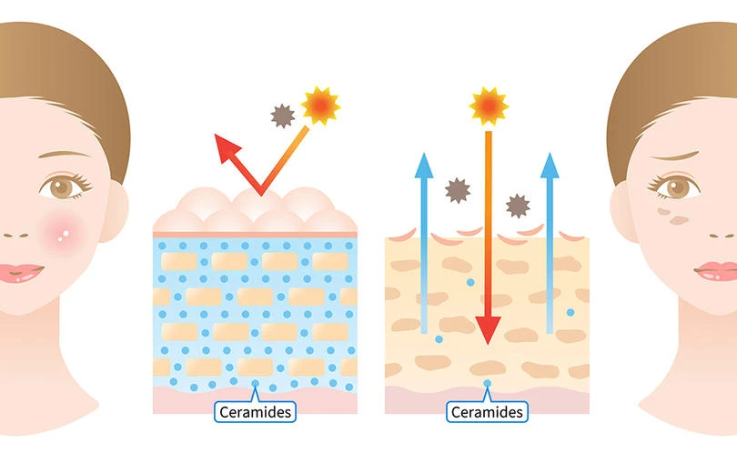 kulit membutuhkan asam lemak ceramide